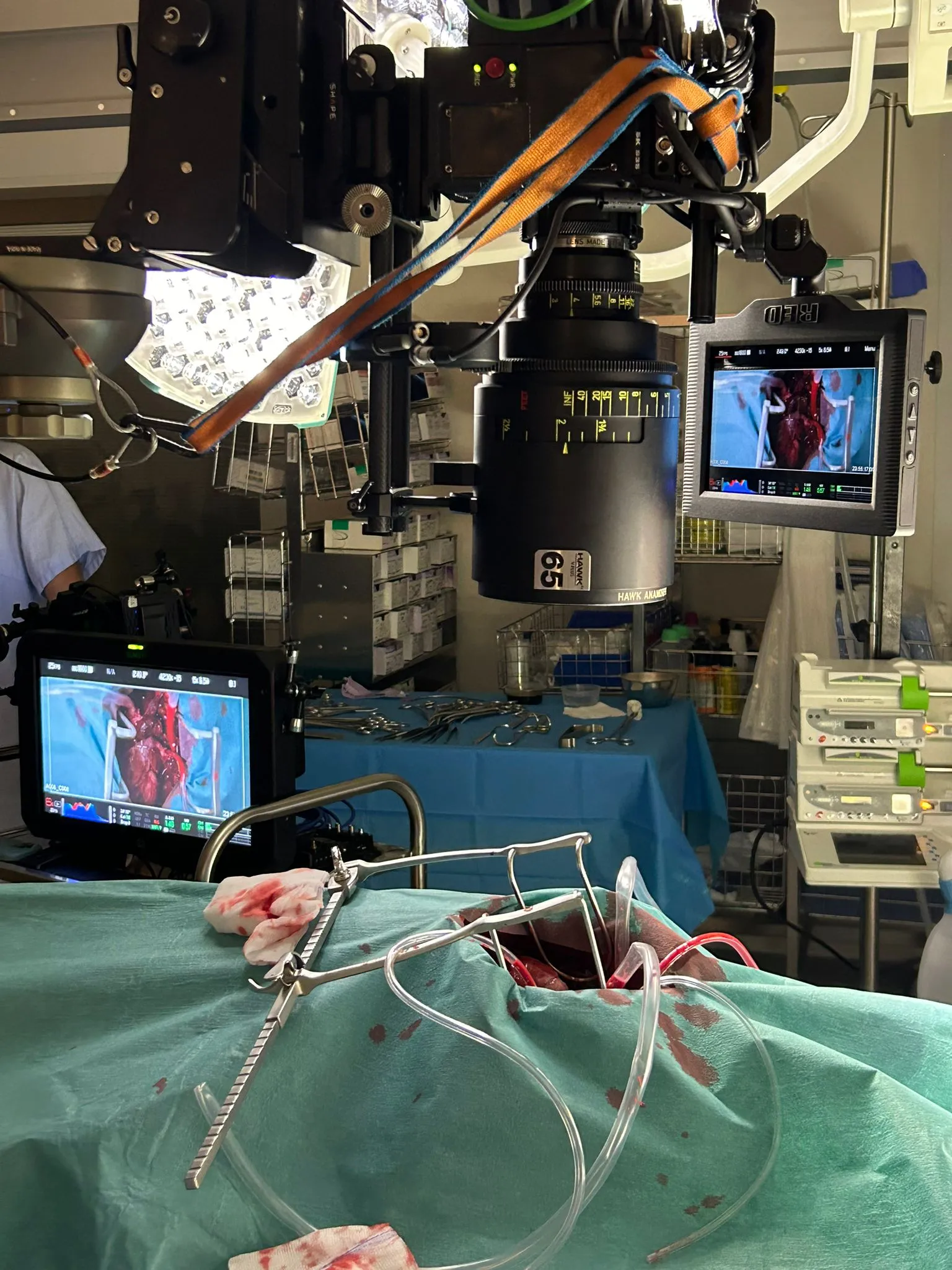 Chirurgische Drehszene — technische Präzision